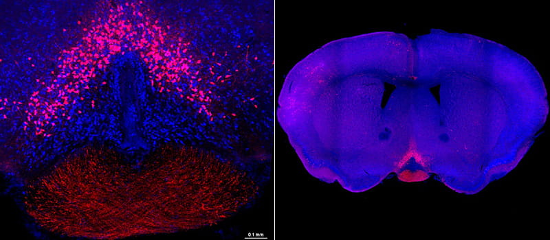 An image showing the location of sunlight-sensing neurons in a mouse brain.